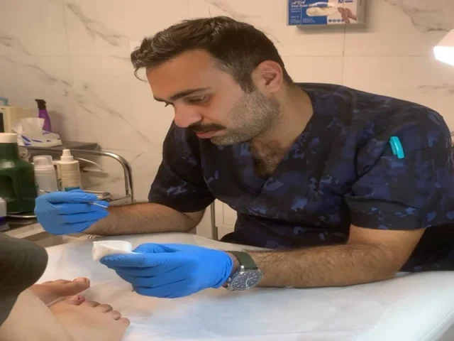 درمان ناخن فرو رفته در گوشت